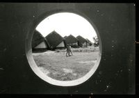 Children in Aspiration through round window
